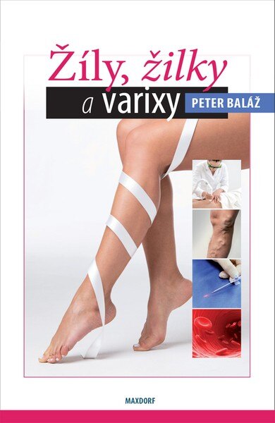 Obálka knihy Žíly, žilky a varixy