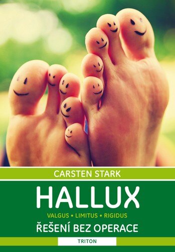 Obálka knihy Hallux: řešení bez operace