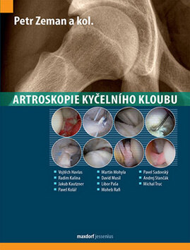 Obálka knihy Artroskopie kyčelního kloubu